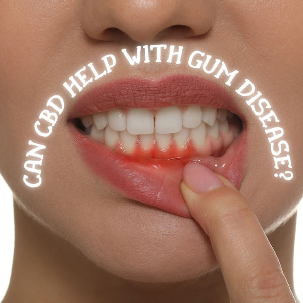 CAN CBD HELP WITH GUM DISEASE?